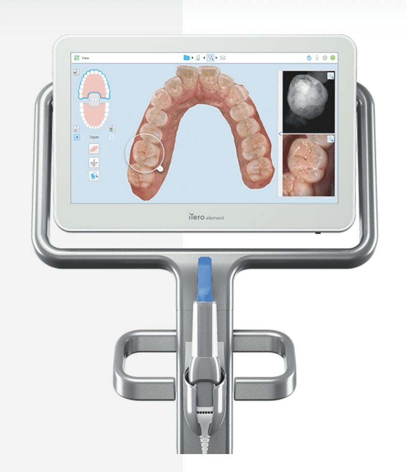 iTero Element Quad City Orthodontics in Bettendorf, IA, Rock Island and Geneseo, IL